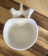 Spine Handle Coffee Mug Kyphon Ahead Of The Curve Advertising Vertebrae