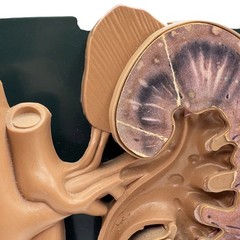 URINARY TRACT ANATOMY MODEL Medical DISPLAY Pharmaceutical RX Advertising Roche