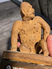 Vintage Pharmaceutical Advertising Figurine Valisone Cream Man With Skin Lesions