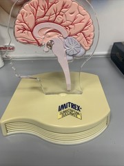 Imitrex Anatomical Head With Brain on base Medical Advertising Display