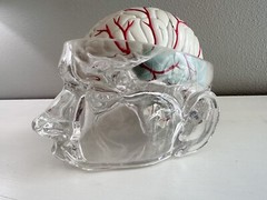 UCB Pharma Lucite Head Skull Brain Model Medical Pharmaceutical Science Display