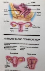 Vintage Pharmaceutical CLIPBOARD OGEN estrogen Female Reproductive System