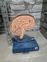 Imitrex 3D 9″ Neuroanatomy Model w Legend Brain Anatomy Medical Science Decor