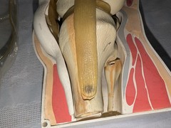 1960s Merck Pharmaceutical Advertising Model „Decadron“ Knee Model