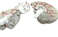 Vintage Seroquel Head Brain Anatomy Pharma Design Sales Display Removable Brain
