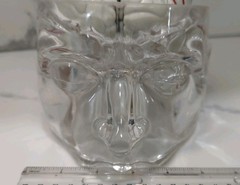 Gliadel Human Brain Anatomy Model w/ Clear Skull PharmaDesign Medical Display