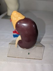 1960s Merck Pharmaceutical Advertising Model „Hydrodiuril Hydropres“ Model
