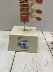 Drug Rep ACTONEL Dr’s Office Display