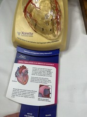 Pharmaceutical Drug Rep Doctors Office Heart Displays Xarelto