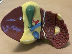 Diseased Liver Anatomical Teaching Model Schering Oncology Biotech Pharmadesign