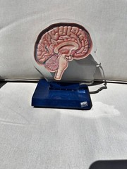 Imitrex 3D 9″ Neuroanatomy Model w Legend Brain Anatomy Medical Advertising