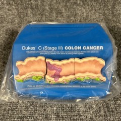Colon Cancer Anatomical Anatomy Model Chart Display Roche Pharmaceutical Xeloda