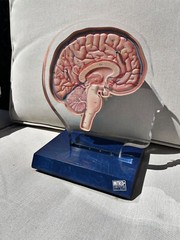 Imitrex 3D 9″ Neuroanatomy Model w Legend Brain Anatomy Medical Advertising