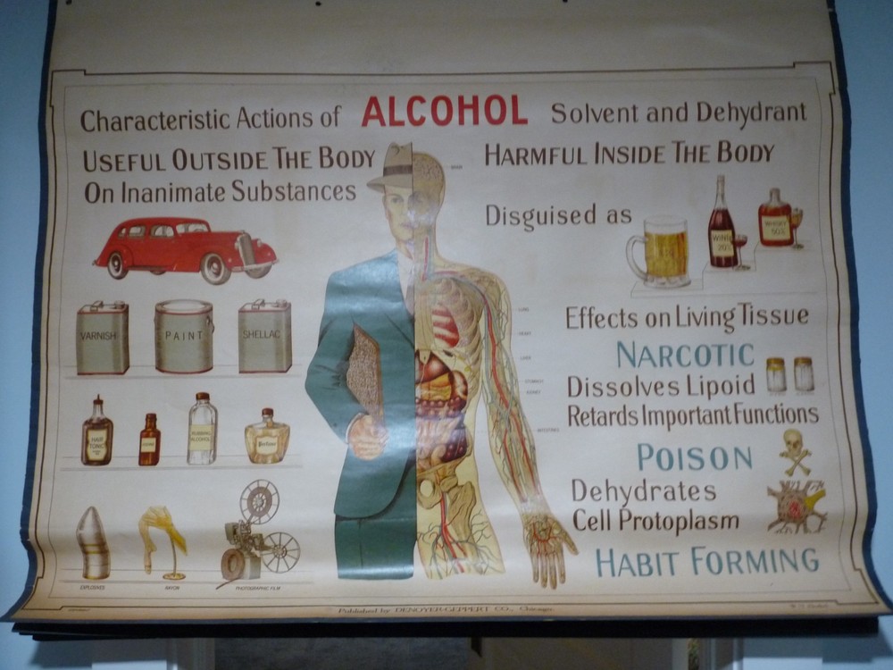 FANTASTIC „ALCOHOL“ 1930S PULL DOWN MEDICAL CHART , DENOYER GEPPERT 44X36