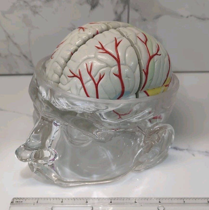 Gliadel Human Brain Anatomy Model w/ Clear Skull PharmaDesign Medical Display