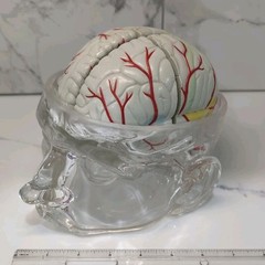 Gliadel Human Brain Anatomy Model w/ Clear Skull PharmaDesign Medical Display
