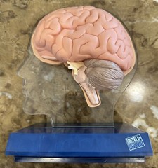 Imitrex (Sumatriptan) 3D 9″ Neuroanatomy Model with Legend – Brain Anatomy