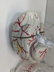 Gliadel Human Brain Anatomy Model w/ Clear Skull PharmaDesign Medical Display