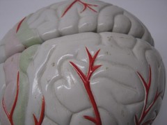 Seroquel Human Brain Anatomy Model w/ Clear Skull PharmaDesign Medical Display