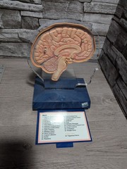 Imitrex 3D 9″ Neuroanatomy Model w Legend Brain Anatomy Medical Science Decor