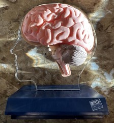 Imitrex (Sumatriptan) 3D 9″ Neuroanatomy Model with Legend – Brain Anatomy