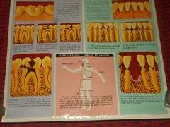 Vintage ANACIN Tablets WHITEHALL Laboratories ADVERTISING Dentist DENTAL POSTER