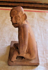 VTG SCHERING PHARMACEUTICAL ADVERTISING FIGURE MAN W/SKIN LESIONS