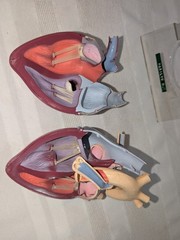 1960s Merck Pharmaceutical Advertising Model „Hydrodiuril Hydropres“ Model