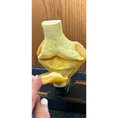 Vtg Feldene Piroxicam Knee Anatomical Pharmaceutical Model 1970’s Base 8″