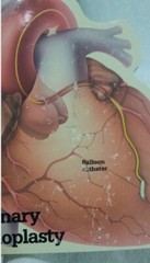 Heart Book Patient Guide to the Human Heart Transderm Nitro Advertising Medical